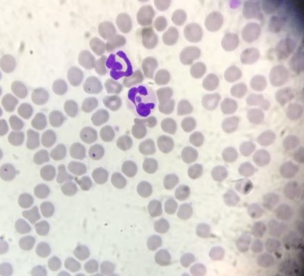 67435F21-16B1-4C51-A4DF-4FC75E83B342