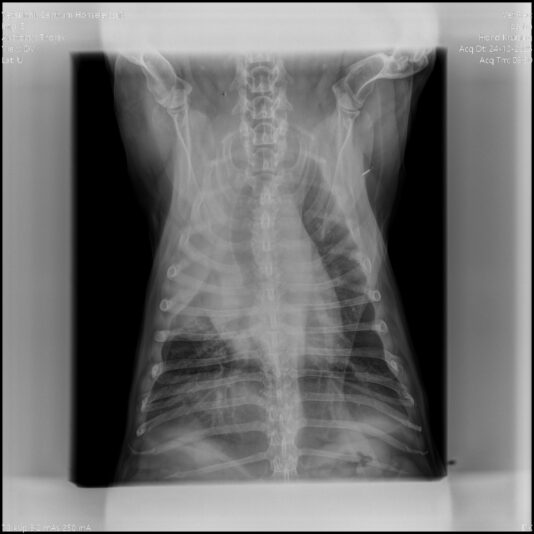 55bd42c6-9086-4bda-98ba-e9ca5669eae9_4_thorax_dv