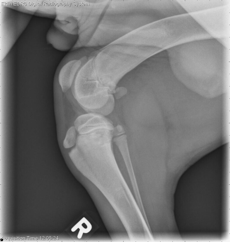 Radiografie van Gewrichten: Klinische Cases