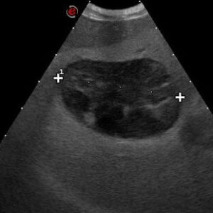 Galblaasmucocele bij de hond