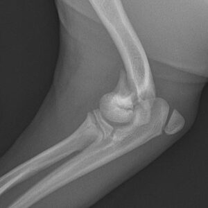 Essential Orthopedie