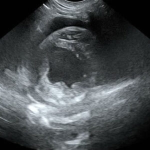 Essential Cardiologie